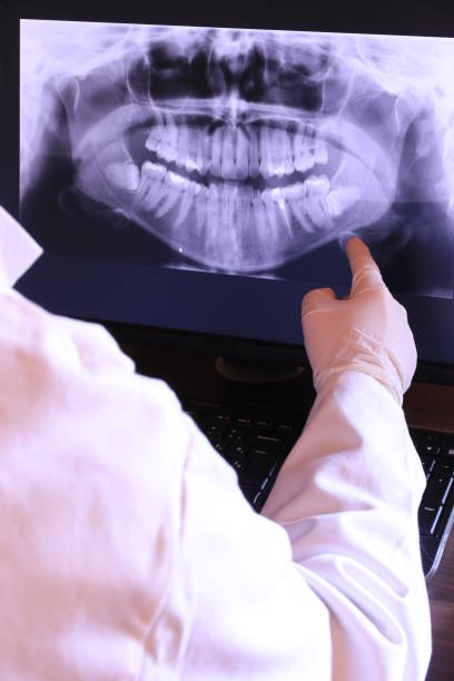 Best Dentist for Tooth Abscess  in Rocky Top, TN