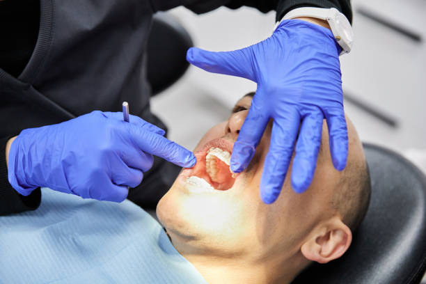 Best Knocked-Out Tooth Emergency  in Rocky Top, TN