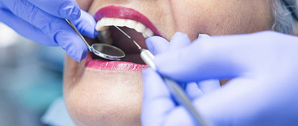 Best Knocked-Out Tooth Emergency  in Rocky Top, TN